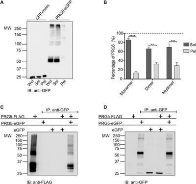 Visualizing multimerization of plasticity-related gene 5 at the plasma membrane using FLIM-FRET